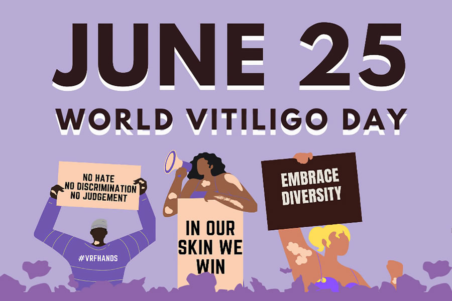 Dia Mundial del Vitiligo 2024