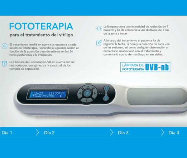 Fototerapia, la mejor opción para tratar el vitíligo cuando falta el sol