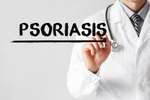 Tratamiento de la psoriasis, terapias tópicas y sistémicas